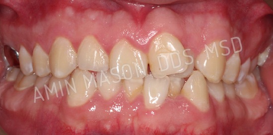 Comprehensive Braces Case before