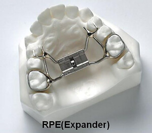 RPE expander