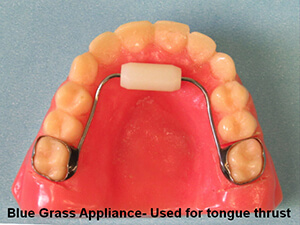 blue grass appliance