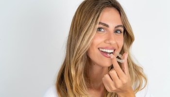 Pretty young woman holding Invisalign aligner