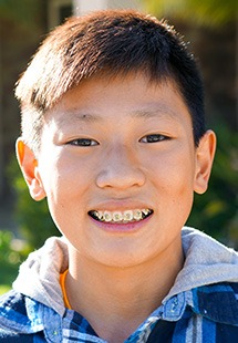 Child smiling while undergoing Phase 1 Orthodontics near Lewis Center