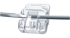 self-ligating braces