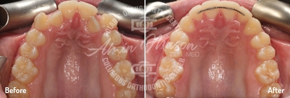 smile case 1