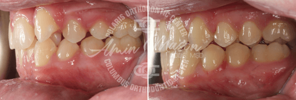 smile case 1