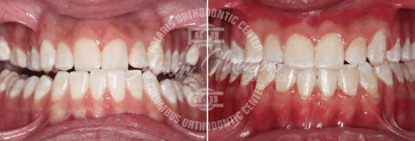 smile case 2