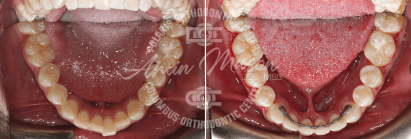smile case 2