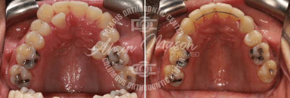 smile case 3