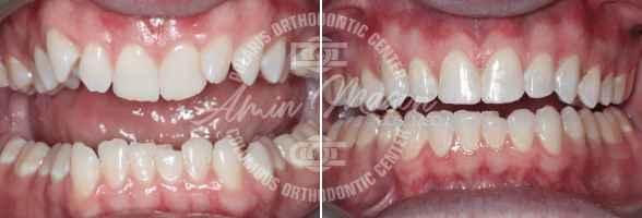 smile case 7