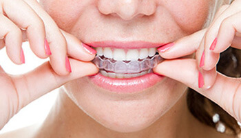 woman putting in invisalign