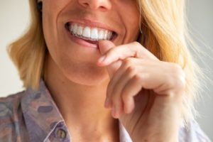 Woman sliding Invisalign aligner onto her teeth